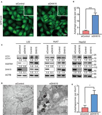 DHX15 Inhibits Autophagy and the Proliferation of Hepatoma Cells